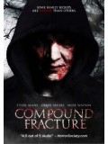 EE2120 : Compound Fracture อาถรรพ์สายพันธุ์ปีศาจ DVD 1 แผ่น